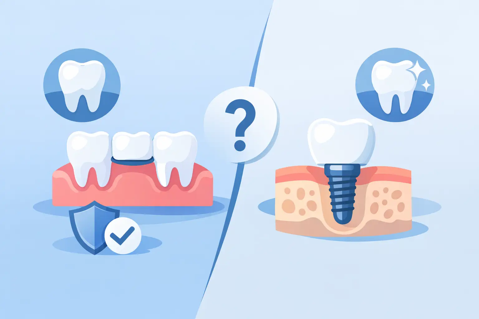 Dental Bridge Versus Implant: Which Fits You?